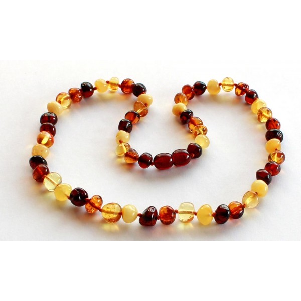 Baroque-Amber-Necklace