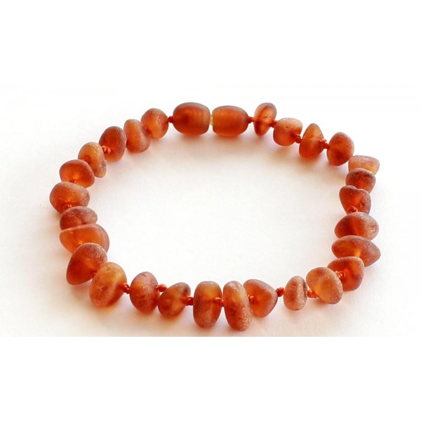 Raw-Amber-Bracelet