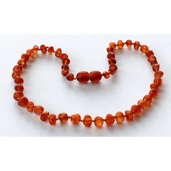 Raw-Baroque-Amber-Teething-necklace